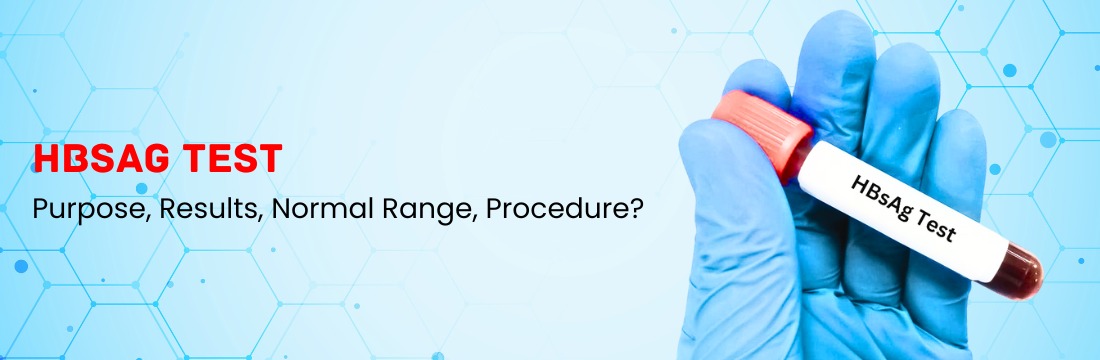 What is HBsAg Test – Purpose, Results, Normal Range, Procedure?